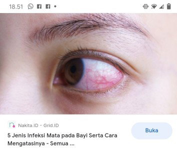 Mata merah seperti akar