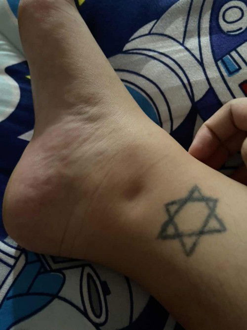 เท้าบวม ท้องจะ9เดือนแล้วคะ