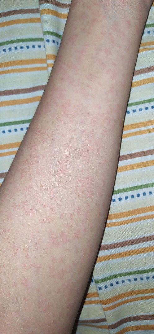 Bintik bintik merah saat hamil