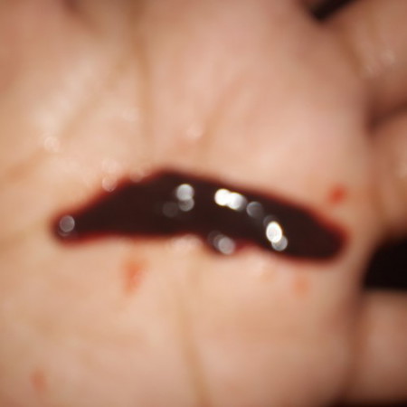 2 months preg. po aq, then knina may lumabas saken n dugo is it miscarriage?