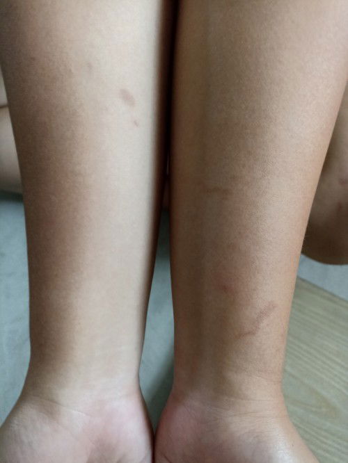 Insect repellant
#1st time moms
#advice pls