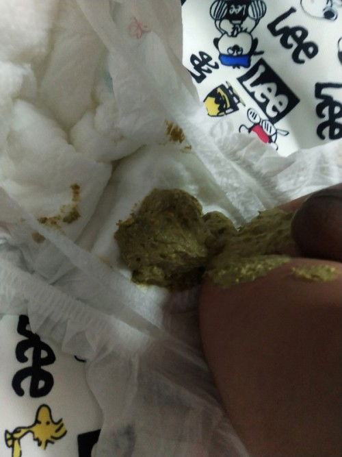 น้องทานนมผงกับน้ำแม่ แบบนี้ปกติไมค่า