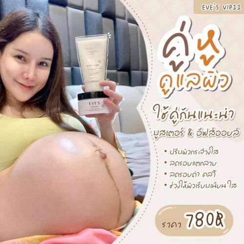 ครีมทาท้องสำหรับแม่ตั้งครรภ์ค่ะ