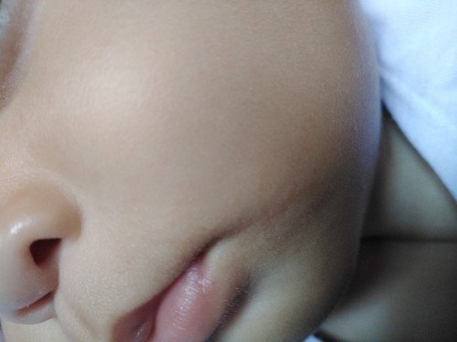 Help! Baby rashes?