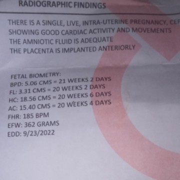 24 WEEKS AND 1 DAY