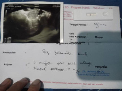 Tespeck positif samar. Di USG masih penebalan dinding rahim.