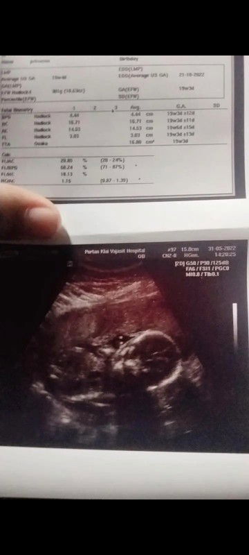 เเม่ๆคนใหนพอทราบบ้างใม่คะ
ว่าเเบบนี้ลูก ญ ลูก ช