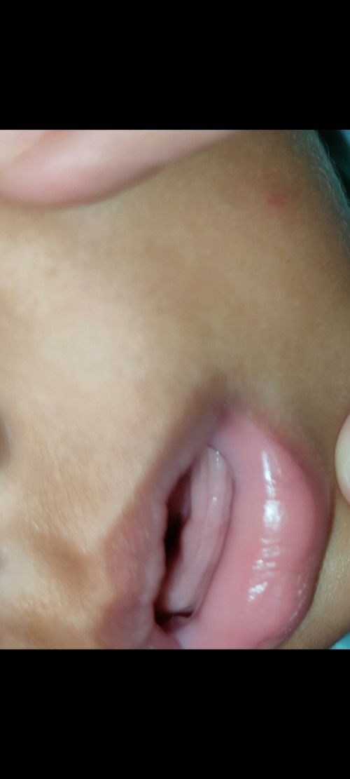 Apa akan tumbuh gigi?