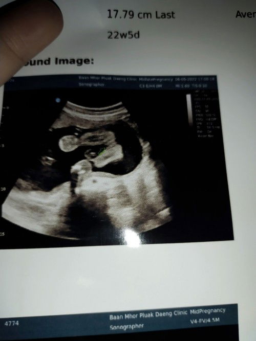 อยากทราบเพศลูก แนะนำหน่อยค่ะ