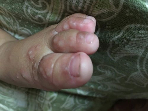 obat dan salep gatal