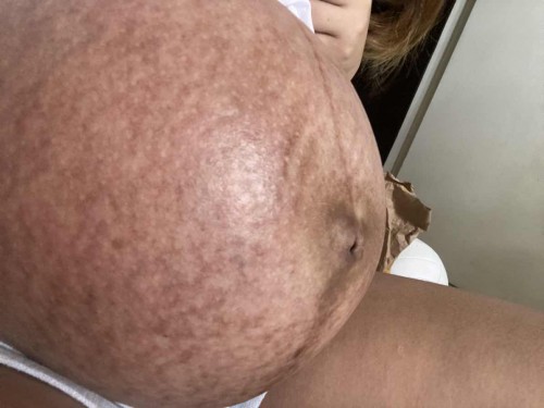 Pregnant belly