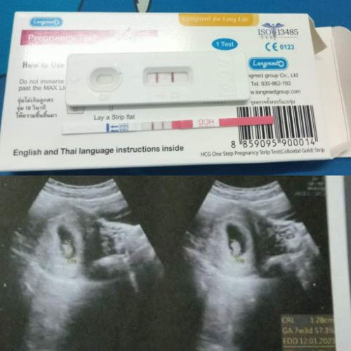 ตั้งครรภ์ได้8week