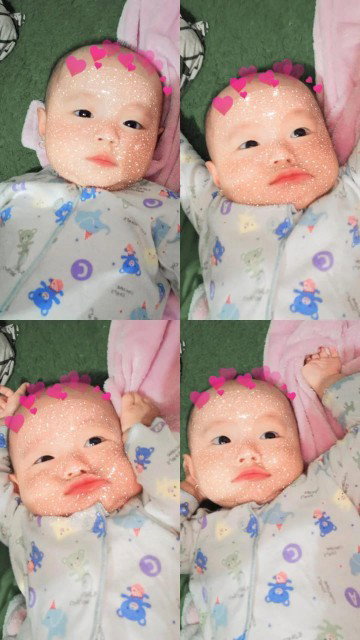 Rambut anak susah tumbuh lagi