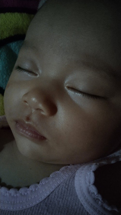 Bayi kuning