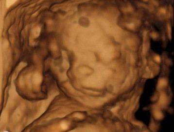 Suggest baby girl name
