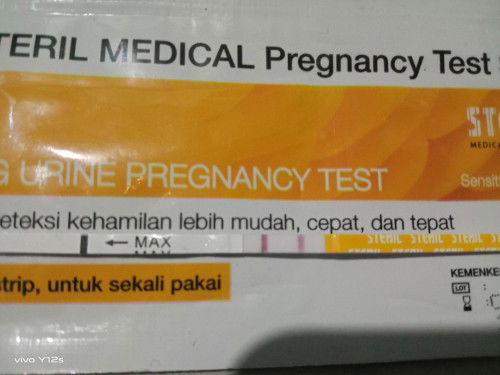 USG bagus nya usia kandungan berapa Minggu