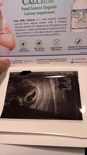 Not seen any heartbeat