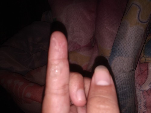 พอดีท้องได้35week 3วัน เเล้วเป็นเเบบนี้ปกติไหมค่ะท้องค่ะมันเป็นใสๆหนืดๆอะคะปกติไหมคะ