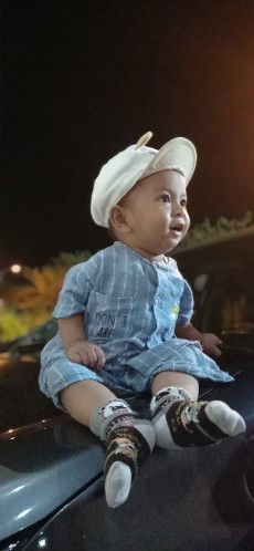 1tahun 4bulan belum berani jalan tanpa dipegang