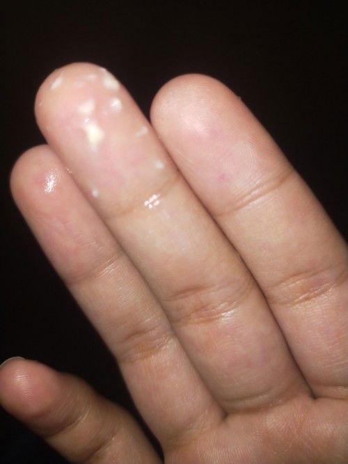 Anong discharge to? Normal ba to?