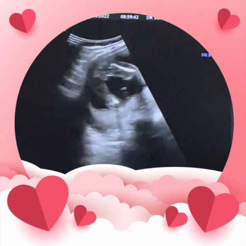 หนูเพศอะไรนะ