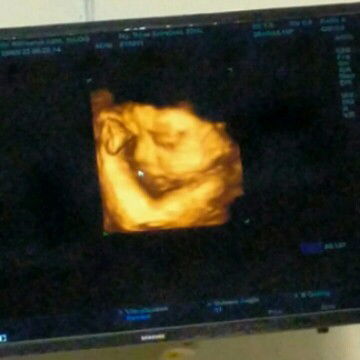 Kehamilan anak pertama