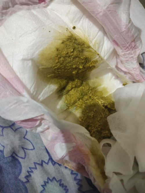 Bakit tumitigas tiyan ng baby ko kapag dumedede 1month and 3weeks old.