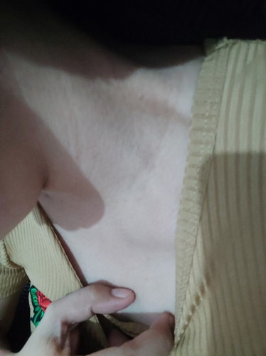 help nman po,ano pwede ipahid sa leeg,bakit parang my line na mahaba parang kwintas na stretch mark.