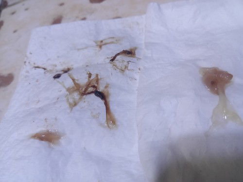 40 week brown discharge? o bloody show