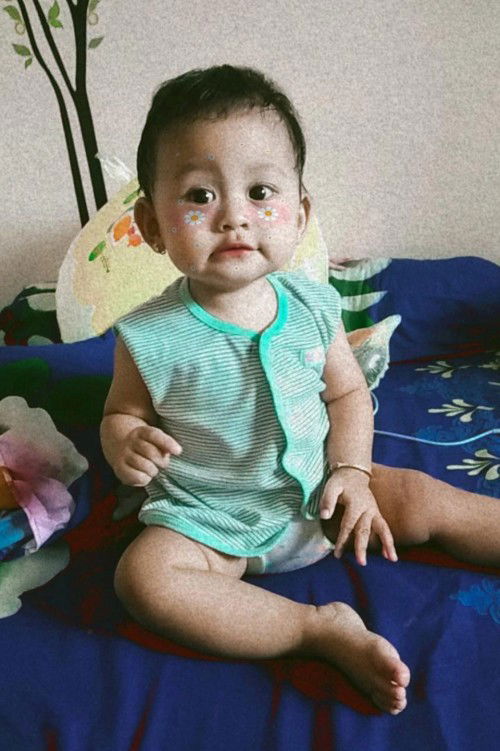 Bayi 9 bulan belum tumbuh gigi