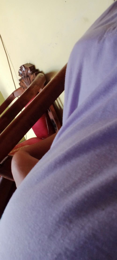 Satu bulan lalu saya baru kuret keguguran 😭,krn bayi tak brkembang terhimpit miom