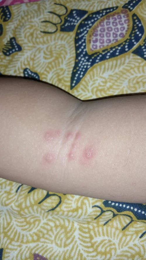 Galau sekali kalo anak sakit 🥺🥺