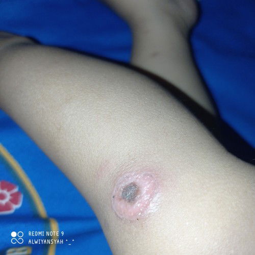 Asalamu'alaikum bunda²