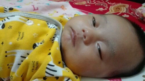 Tidur tapi mata sedikit terbuka