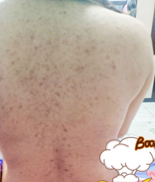 ท้องคนที่2