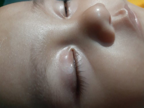 Mata anak seperti bintitan