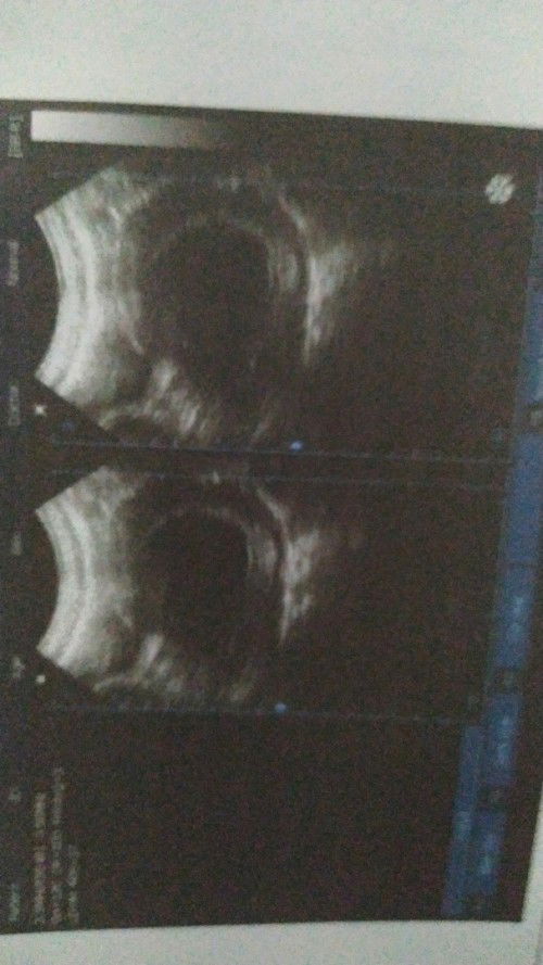 Janin belum terlihat