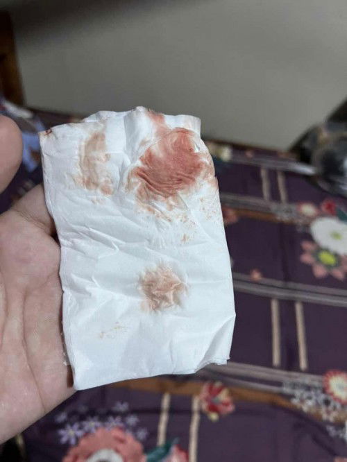 Mga mommy normal lang ba na mag bleeding after ma First I.E??