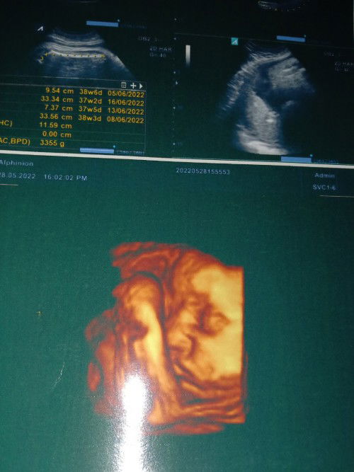 Ingin menjadi seorang ibu