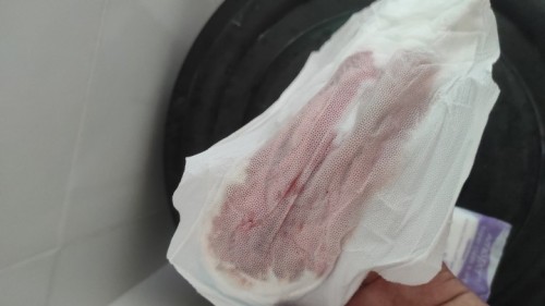 implantation bleeding po ba or menstruation