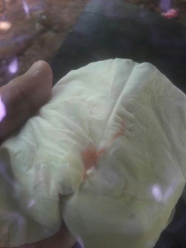 มีมูกปนเลือด