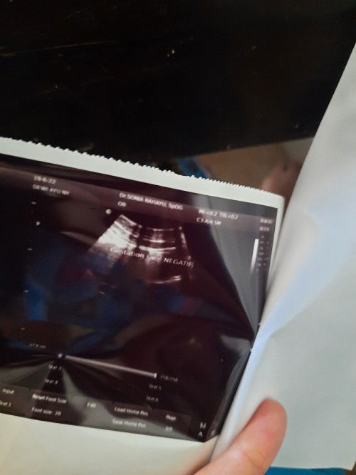 Hasil ugs HPHT 16 April, tp garis 2 tp hasil usg gitu. Ada yg sama?