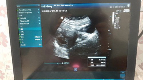 Uk 8w tp.belom terlihat janin