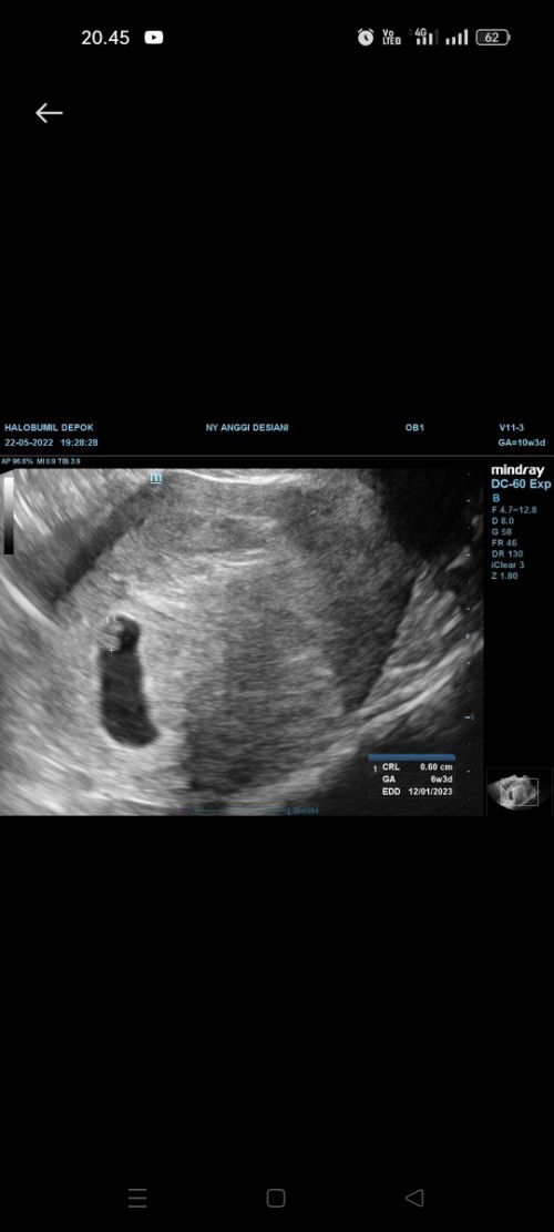 Belum dikasih amanah