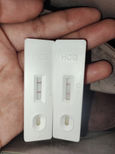 Pregnancy with IUD