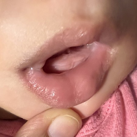 Is she teething?