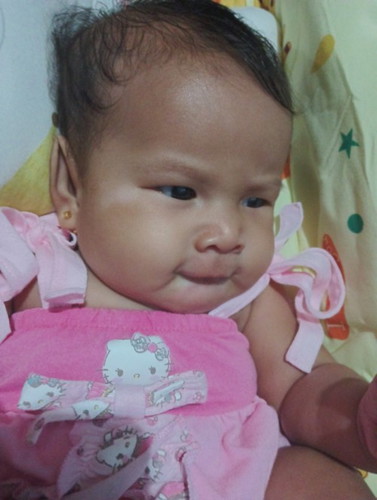 White patches sa gilid Ng Mata at chin ni Baby
