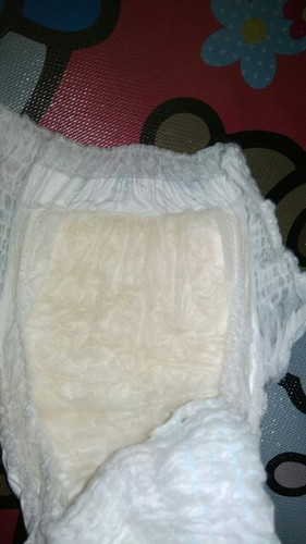 Urin bayi berwarna pekat