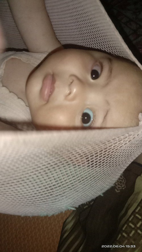 Sakit mata