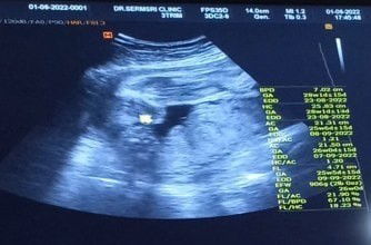 27w6d ☺☺ #ท้อง2